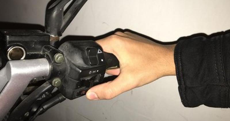 Bukan Cuma Aki, 4 Komponen Ini Bisa Jadi Penyebab Motor Matic Sulit Distarter